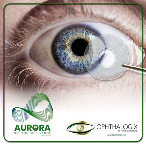 Treating Complex Eye Conditions