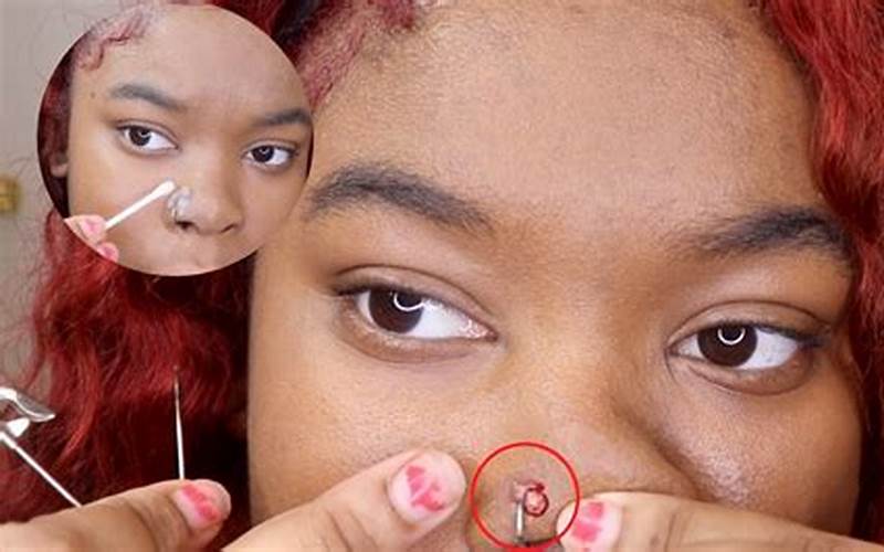 Treatment Nose Piercing Bump Keloid