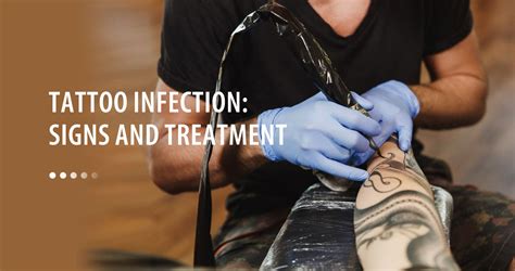 Treatment For Tattoo Infection