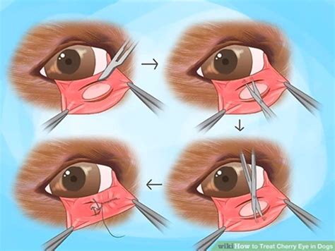 Treatment Options for Cherry Eye