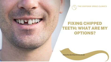 Treatment Options for Chipped Teeth