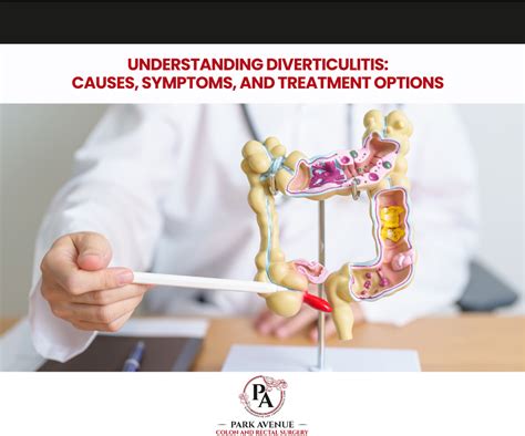 Treatment Options for Sigmoid Diverticulitis
