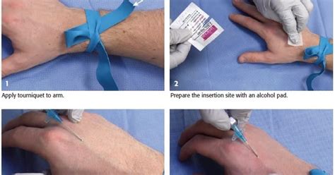 Tricks How To Hit A Vein Every Time