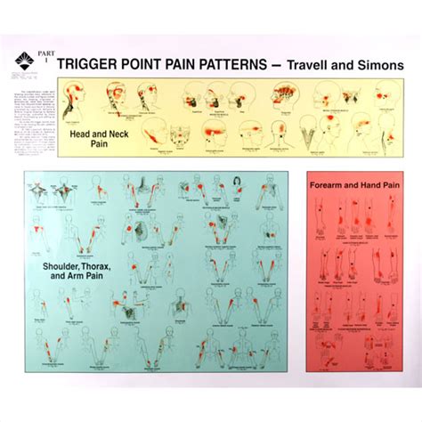 Trigger Point Pain Patterns