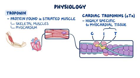 Troponin & Heart Attacks: What You Need to Know.