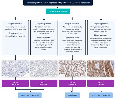 Tumor Grading Test and interpretation