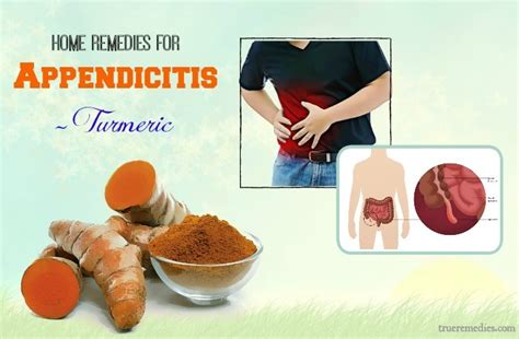 Turmeric for Appendicitis: Relief & Recovery Tips