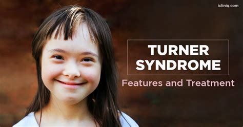 Turner Syndrome Image