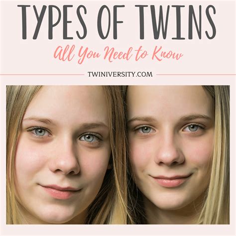 Twins: Differences & What You Need to Know.