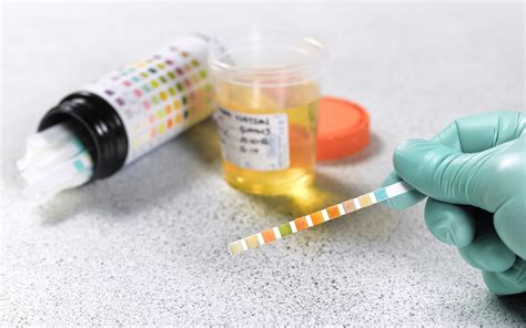 Types of Drug Tests