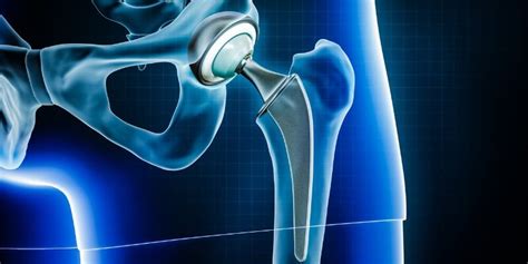 Types of Dog Hip Operation Procedures