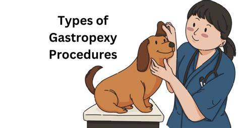 Types of Gastropexy Procedures
