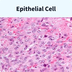 Types of Mesothelioma Cells Identified