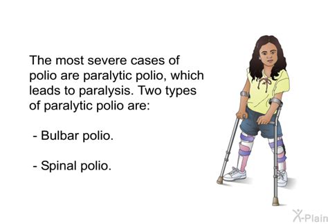 Types of Paralysis in Polio