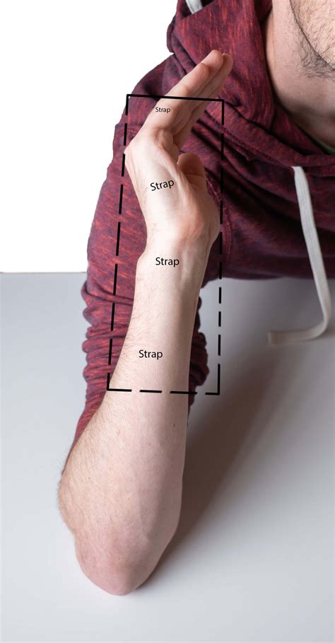 Ulnar Gutter Splint Pattern