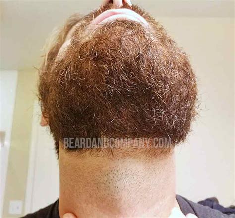 Under Beard Pictures