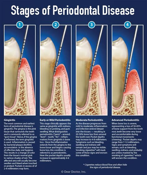 Understanding Bakersfield Periodontal Therapy