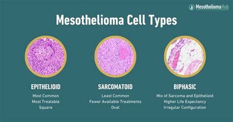 Understanding Cell Types in Mesothelioma