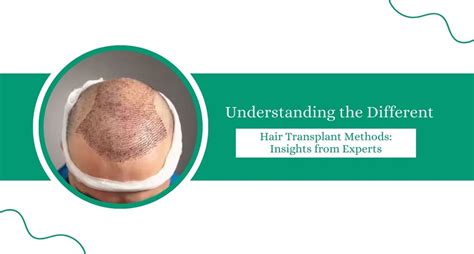 Understanding Different Hair Treatments