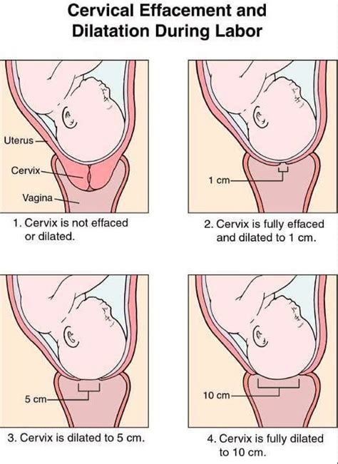 Understanding Dilation and What Comes Next