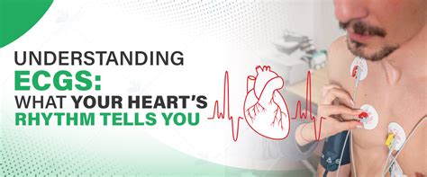 Understanding ECGs: Your Heart Health Explained.