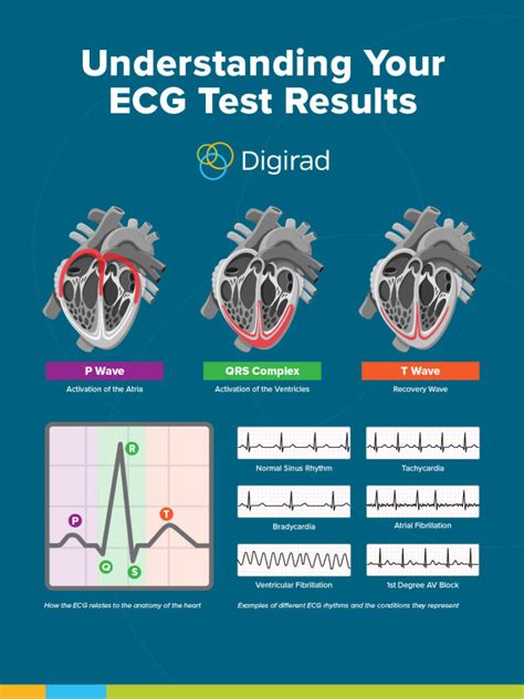 Understanding EKG Tests