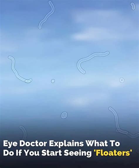 Understanding Eye Floaters: What Are Those Pesky Shadows?