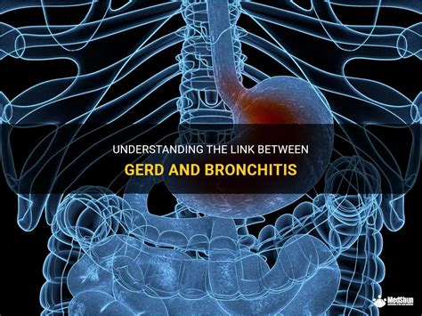 Understanding GERD Bronchitis