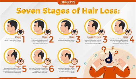 Understanding Hair Loss Stages