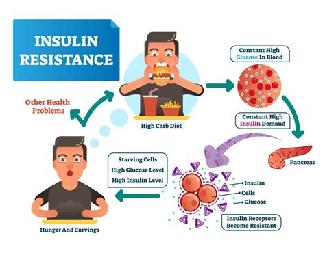 Understanding Insulin Resistance: The Root Cause