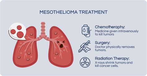 Understanding Mesothelioma: Key Facts