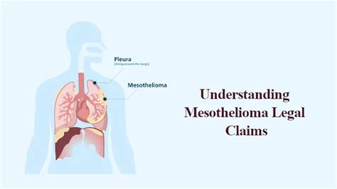 Understanding Mesothelioma Claims
