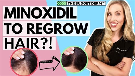 Understanding Minoxidil Products