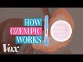 Understanding Ozempic and Its Primary Use