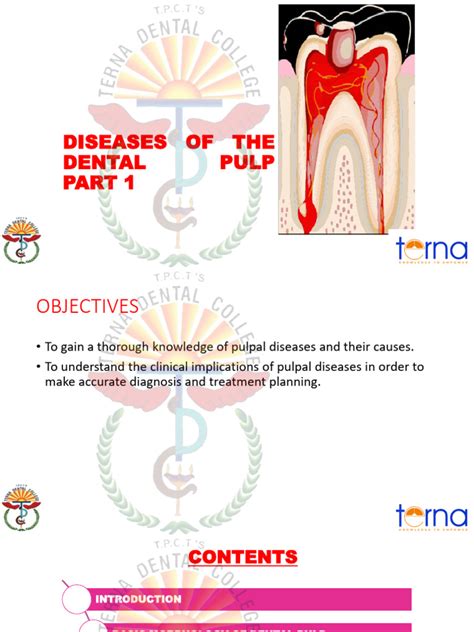 Understanding Pulpal Health in Tucson