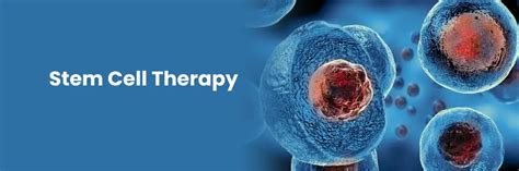 Understanding Stem Cell Therapy in Milwaukee