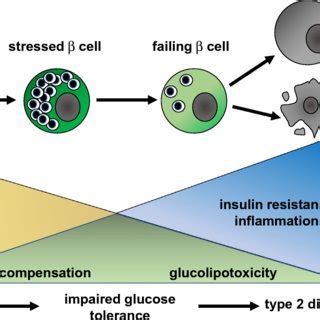 Understanding T2D Progression Leading to Insulin Use