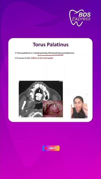 Understanding This Unique Oral Feature