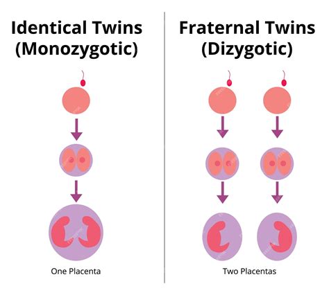 Understanding Twin Conception Identical vs Fraternal
