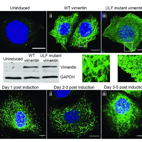 Understanding Vimentin Expression Levels