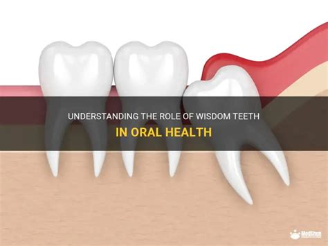 Understanding Wisdom Teeth and Their Role