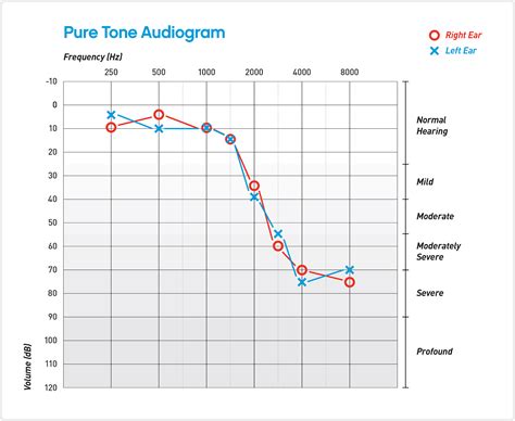Understanding Your Audiogram