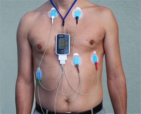 Understanding Your Holter Monitor