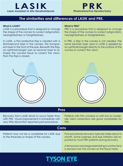 Understanding Your Options: LASIK vs. PRK