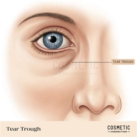 Understanding Your Under-Eye Area