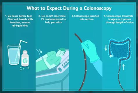 Understanding the Colonoscopy Procedure During Menstruation
