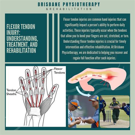 Understanding the Flexor Strain Injury