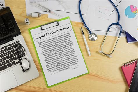 Understanding the ICD 10 Code for SLE