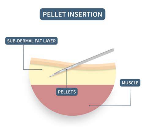 Understanding the Pellet Insertion Procedure