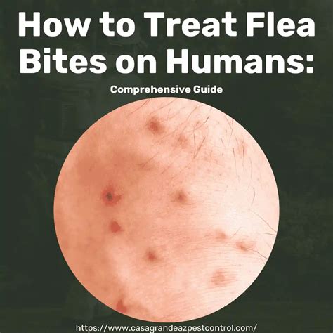 Unveiling the Secrets: A Comprehensive Guide to Conquering Flea Bites on Humans